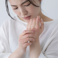 皮膚のかゆみ・湿疹・ニキビ